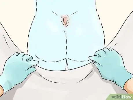 Image titled Get Rid of a Cyst Step 13