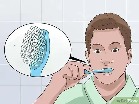 Image titled Clean Your Teeth After Wisdom Teeth Removal Step 4
