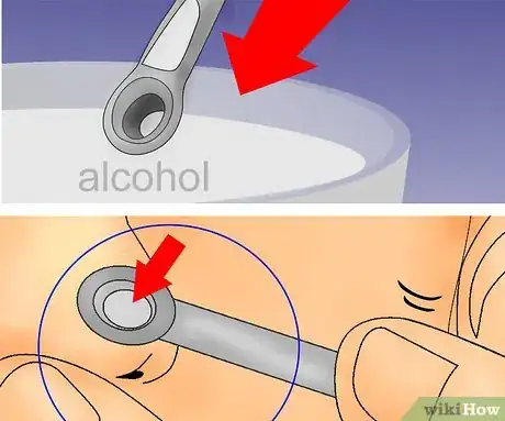 Image titled Remove Blackheads and Whiteheads with a Comedo Extractor Step 7
