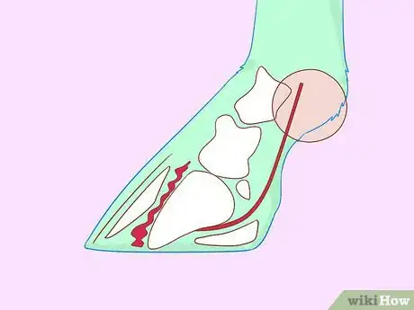 Image titled Recognize and Treat Laminitis (Founder) in Horses Step 1