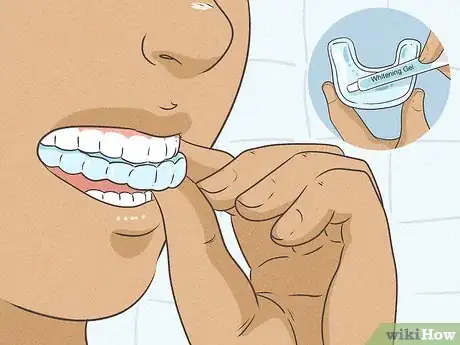 Image titled Whiten Teeth in an Hour Step 8