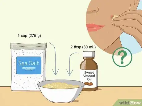 Image titled Get Rid of Pimples Naturally (Sea Salt Method) Step 3