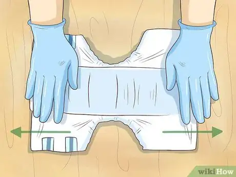 Image titled Change a Disposable Adult Diaper While Standing Step 4