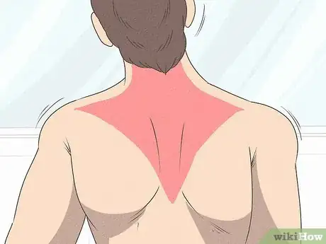 Image titled Heal a Pulled Trapezius Muscle Step 1