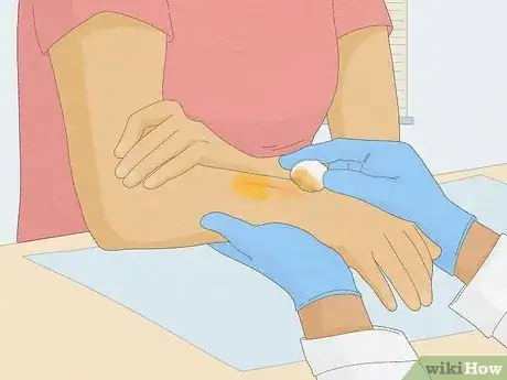 Image titled Remove Iodine Stains from Skin Step 7