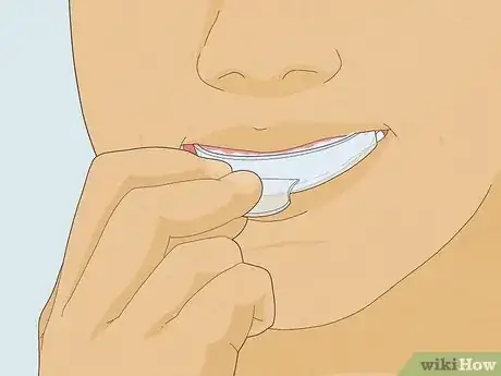 Image titled Use the LED Light to Whiten Teeth with Whitening Trays Step 3