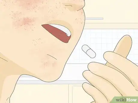 Image titled Treat Face Eczema Step 10
