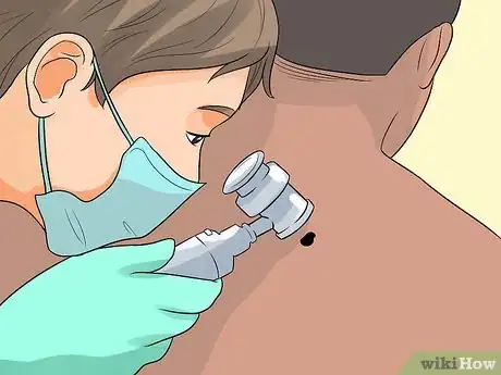 Image titled Remove a Raised Mole Step 1