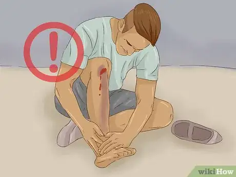 Image titled Treat a Rattlesnake Bite Step 11