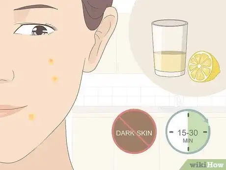 Image titled Get Rid of Acne Redness Fast Step 2