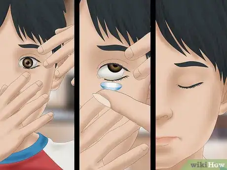 Image titled Put Contact Lenses in Your Child's Eyes Step 7