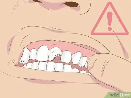 Image titled Make Fake Braces or a Fake Retainer Step 20