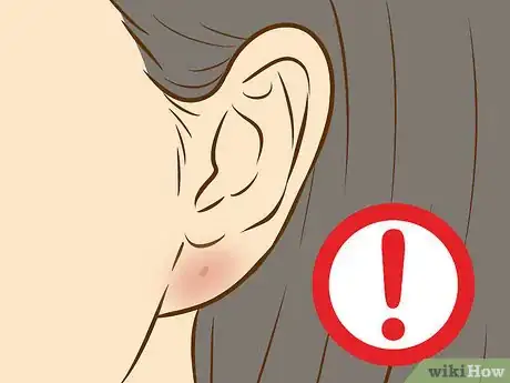 Image titled Get Your Ears Pierced Step 17