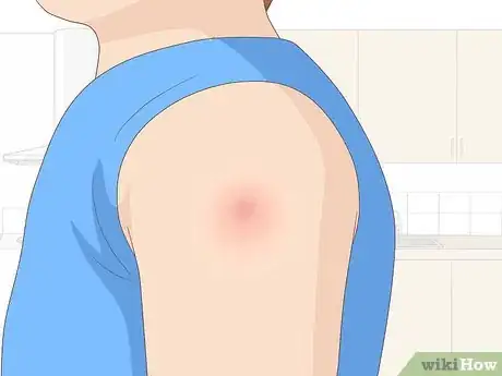 Image titled Get Vaccinated Step 10