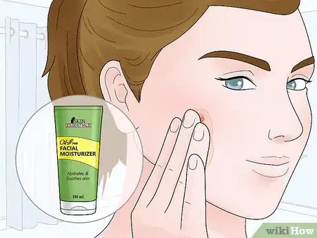 Image titled Manage Pimples and Still Be Beautiful Step 3