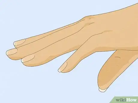 Image titled Get Rid of White Spots on Your Nails Step 7