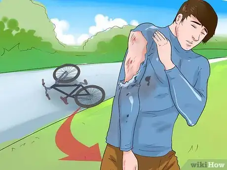 Image titled Treat Road Rash Step 1