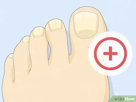 Image titled Have Pretty Toenails Step 4