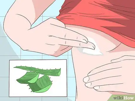 Image titled Get Rid of a Rash Under Breasts Step 5