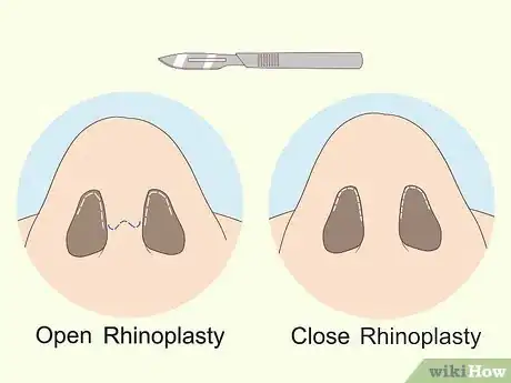 Image titled Fix a Crooked Nose Step 4
