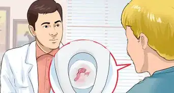 Stop Hemorrhoids from Itching