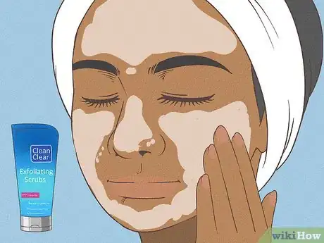 Image titled Keep Your Face Clean Step 11