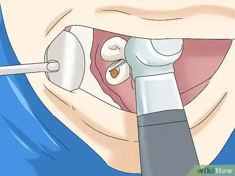 Image titled Relieve Tooth Abscess Pain Step 11