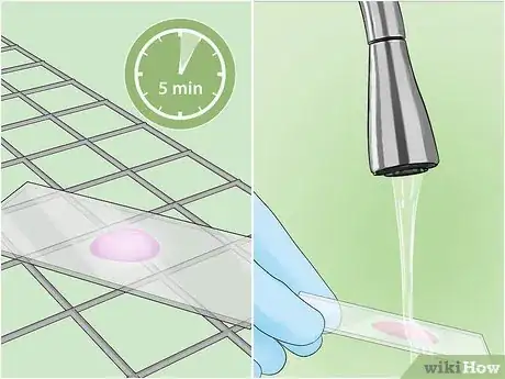 Image titled Identify Bacteria Step 17