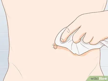 Image titled Clean Your Belly Button Step 1