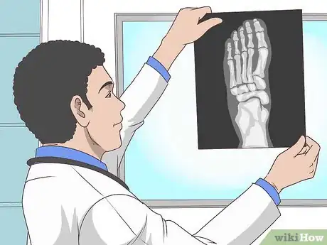 Image titled Identify a Stress Fracture Step 16