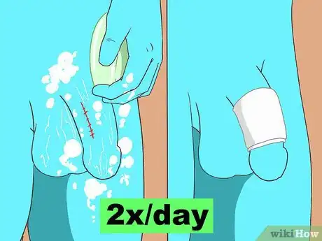 Image titled Get Rid of Genital Warts Step 11