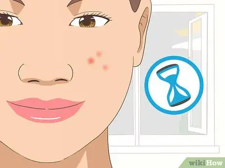 Image titled Use Tea Tree Oil for Acne Step 6