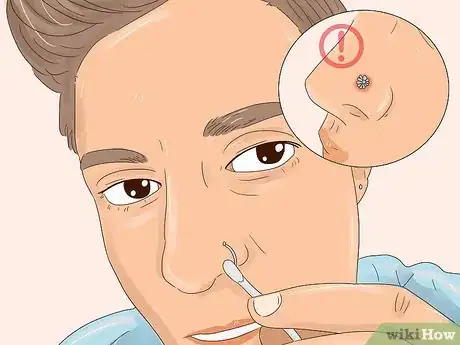Image titled Get Your Nose Pierced Step 16