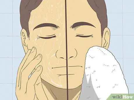 Image titled Wash Your Face when You Have a Sensitive Skin Step 6