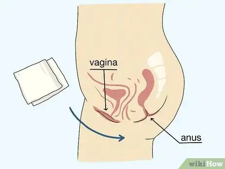 Image titled Control Vaginal Discharge Step 2