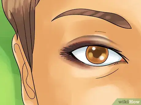 Image titled Make a Double Eyelid Step 15