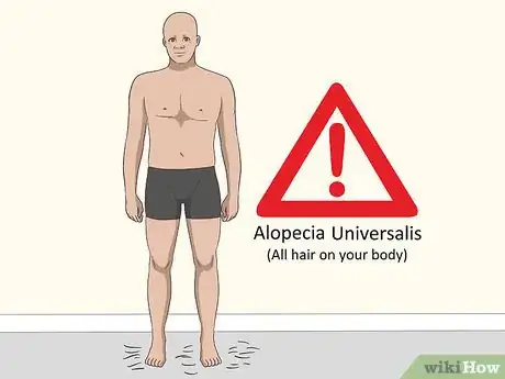 Image titled Treat Alopecia Step 14