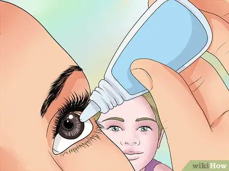 Image titled Easily Give Eyedrops to a Baby or Child Step 5