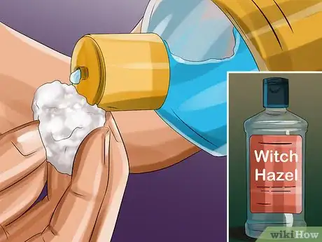 Image titled Apply Witch Hazel to Your Face Step 3