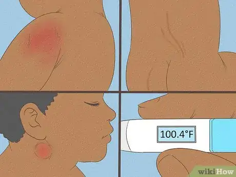 Image titled Know What to Expect on a Newborn's Skin Step 21