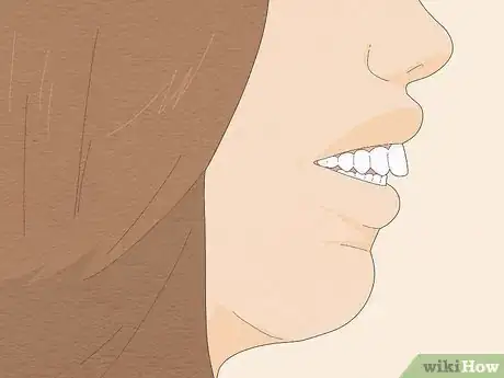 Image titled Fix an Overbite Step 1