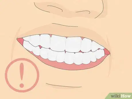 Image titled Fix Crooked Teeth Step 16