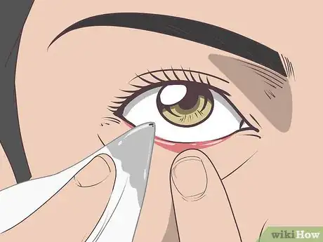 Image titled Get Stuff out of Your Eye Step 13