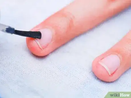 Image titled Make Your Nails Grow Faster and Keep Your Hands Soft Step 1