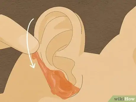 Image titled Wax Ear Hairs Step 9