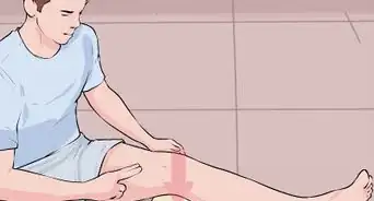 Cure a Baker's Cyst