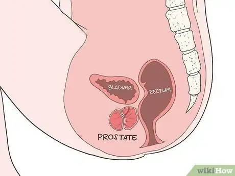 Image titled Locate Your Prostate Step 6