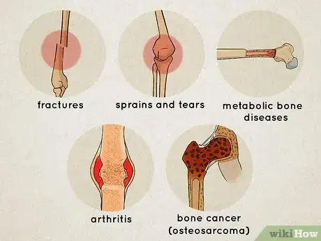 Image titled Understand the Human Skeletal System Step 11