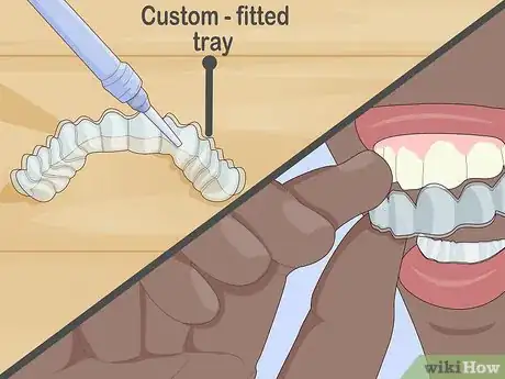 Image titled Protect Gums During Teeth Whitening Step 4