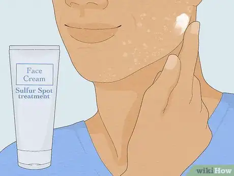 Image titled Get Rid of White Spots on the Skin Due to Sun Poisoning Step 2